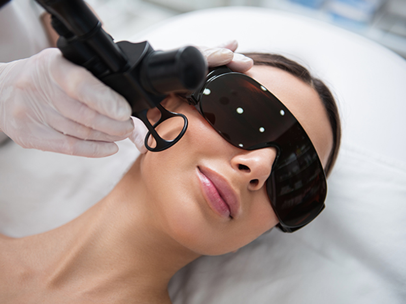 fractional CO2 laser
